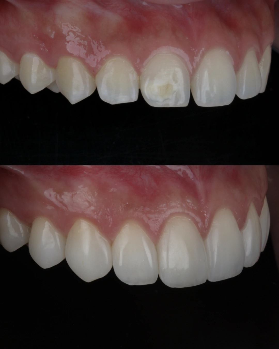 Comparativo clínico original con las fotografías de antes y después, caso 3