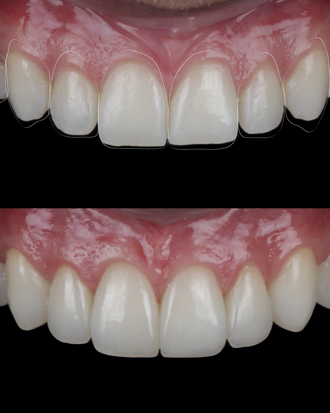 Comparativo clínico original con las fotografías de antes y después, caso 4