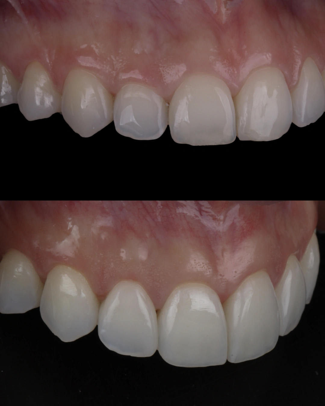 Comparativo clínico original con las fotografías de antes y después, caso 7