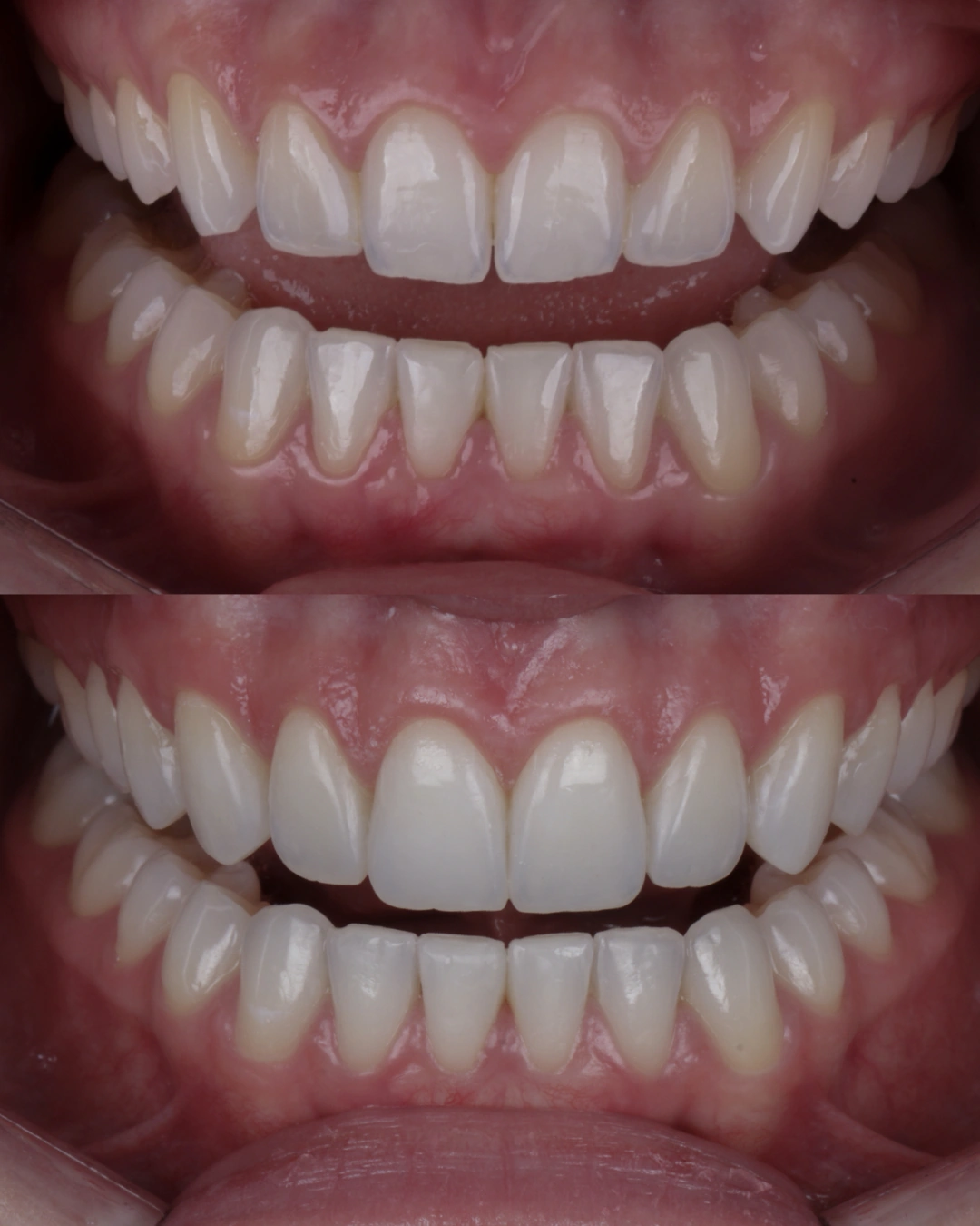 Comparativo clínico original con las fotografías de antes y después, caso 8